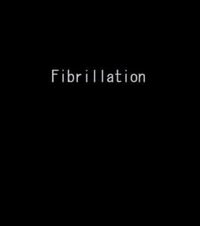 Fibrillation cover